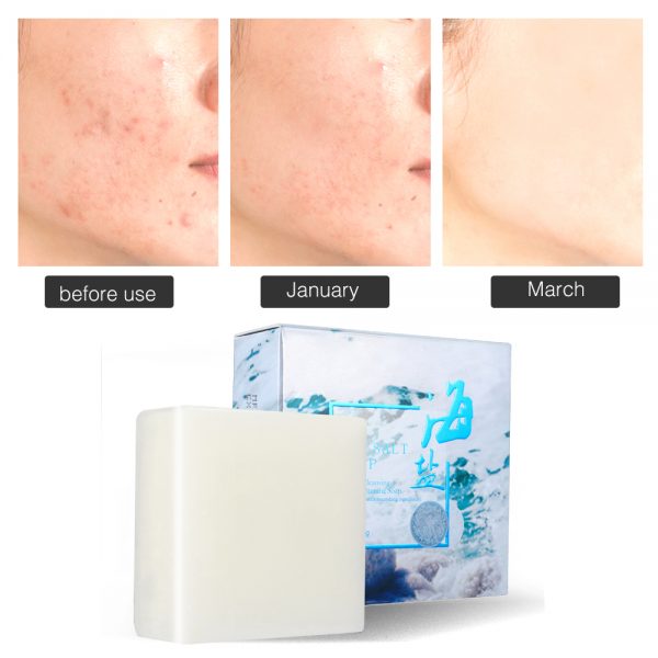 Face Whitening Soap Morrocan Black Soap Whitening Soap Skin