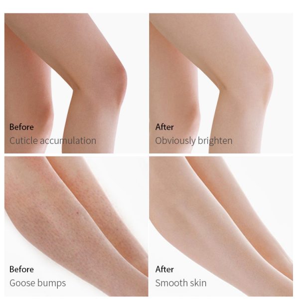 Best Sugar Scrub For Body Body Hand Scrubs Package