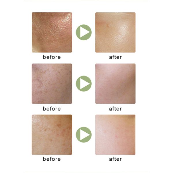 Coco And Eve Body Scrub Exfoliating Body Wash Scrub Shower Gel
